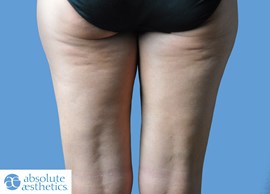 Women's Anti-Cellulite Leg Shaper Slimming Tights Stocking Compression  Pantyhose 