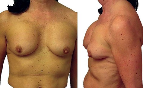 https://www.thepmfajournal.com/media/2384/breast_james_fig-3.jpg?width=474;height=294