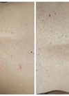 Photos showing pigmentation issues.