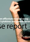 Chronic telogen effluvium reversal article graphic link image.