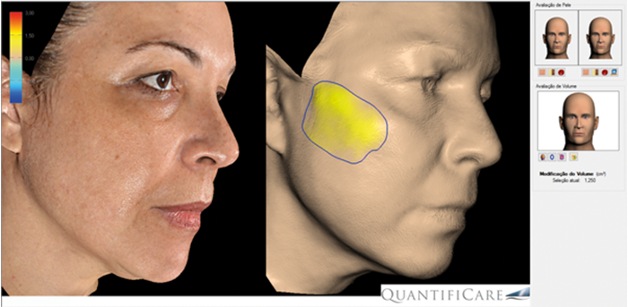 3d Photography In Facial Rejuvenation The Pmfa Journal